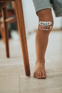 band aid on kid's knee